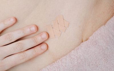 Cicatriz de cesariana a repuxar ou a doer: quando procurar avaliação?